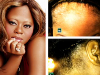 Countess-Vaughn-Reveals-Suffering-From-Scalp-Infections-Due-To-Lace-Wigs-450x275
